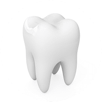 歯のメインテナンス予防歯科